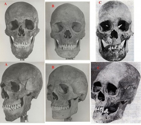 A: embertanilag az europid formakörbe tartozó férfi koponyája. Naïmaa-Tolgoï lelőhely, i.sz. 1. század* B: europid túlsúlyú, de mongolid jellegeket is mutató női koponya. Naïmaa-Tolgoï lelőhely, i.sz. 1. század* C: embertanilag mongolid (ezen belül bajkáli) típusú férfi koponya. Noin-Ula lelőhely, i.e. 1. század** 