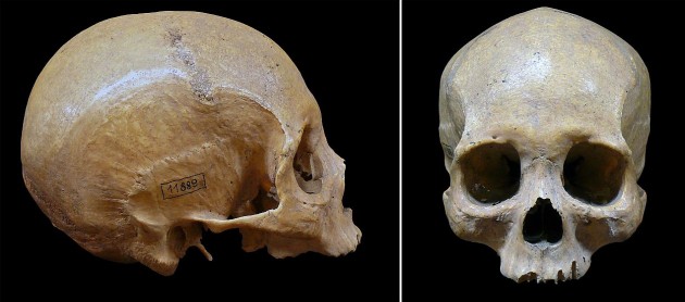Embertanilag mongoloid típusú, hunnak tartott férfi koponya Szőreg-Téglagyár gepida temetőjéből